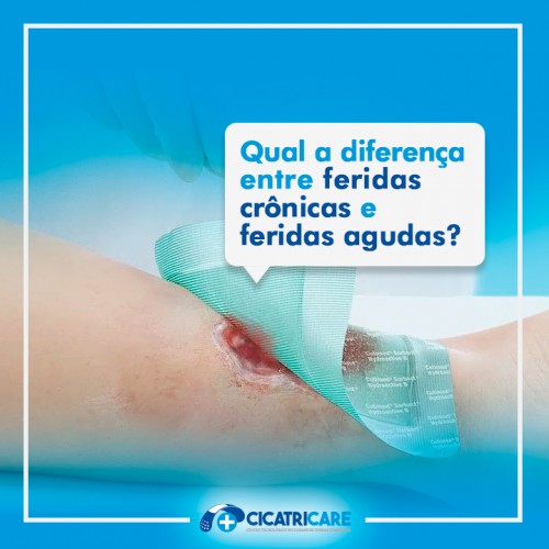 Qual a diferença entre feridas crônicas e feridas agudas?