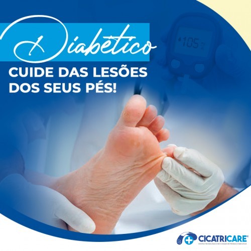 Diabético cuide das lesões dos seus pés!