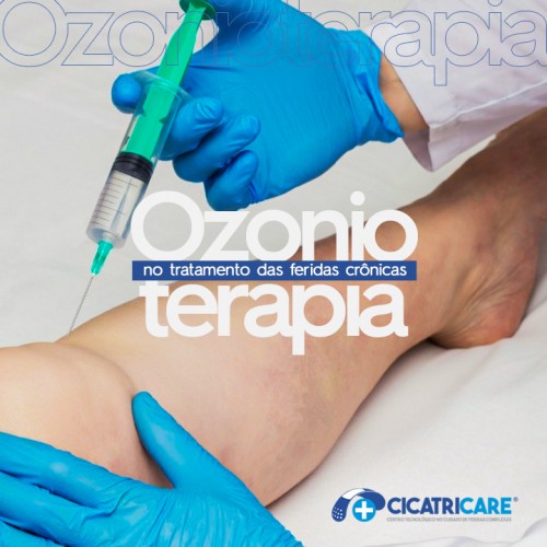 A ozonioterapia no tratamento das feridas crônicas