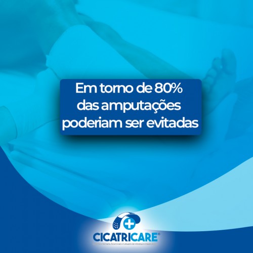 Em torno de 80% das amputações poderiam ser evitadas