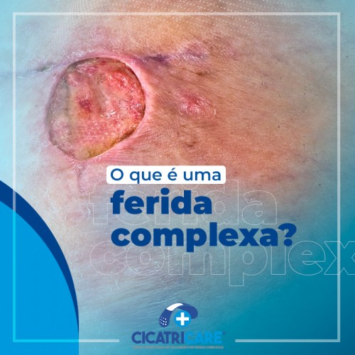 O que é uma ferida complexa?